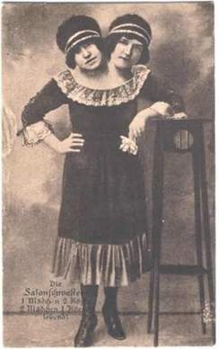 freak-show-circo-victoriano-fenomenos-monstruos-perturbador(7)